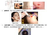【轉(zhuǎn)載】《艾灸并不復(fù)雜》