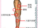 【轉載】名醫教你：身體疼痛與疾病關系圖解