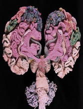 神经科学艺术家Karen Norberg的编织人脑